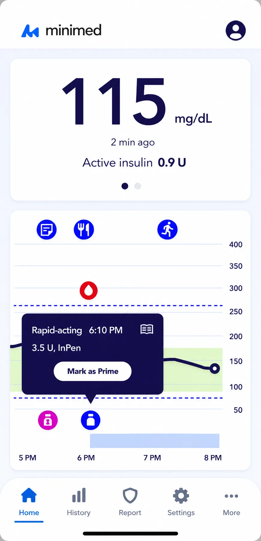 MiniMed Go dashboard — live 115 mg/dL